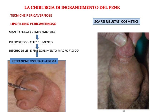 Operazione su aumento del nome di membro