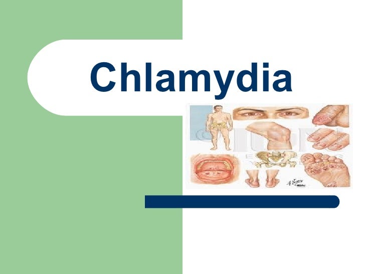 Chlamydia