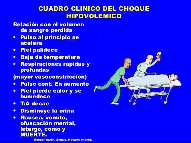 Choque hipovolemico