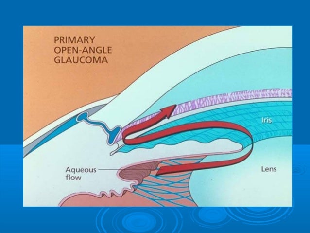 enhance trial vytorin enhance trial vytorin