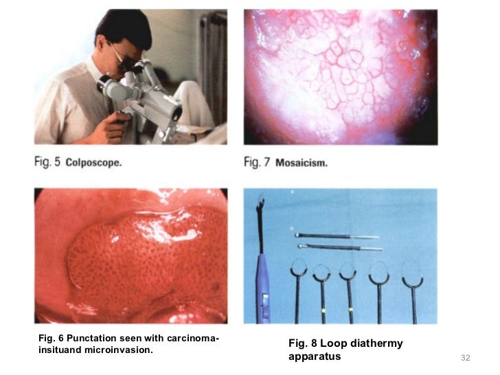 Gynecology 5th year, 9th lecture (Dr. Hanaa)