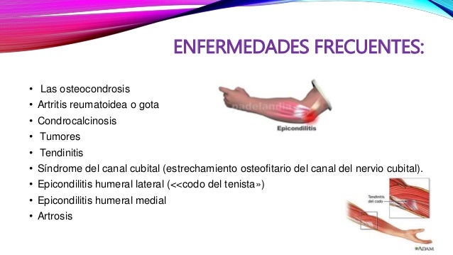 Sheynyy la osteocondrosis el mecanismo del desarrollo
