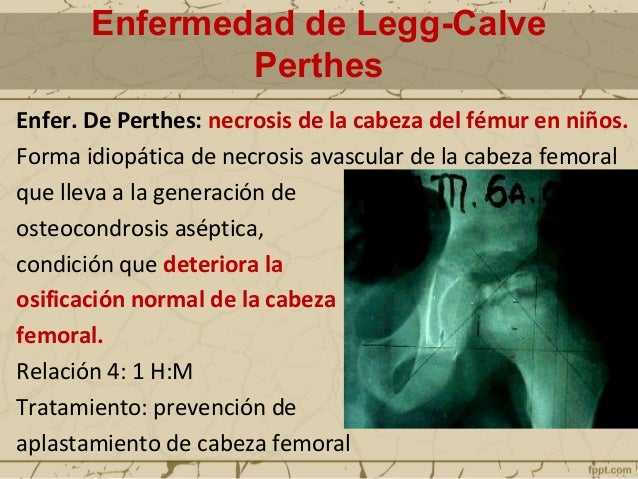 El gel feloran al dolor en la espalda