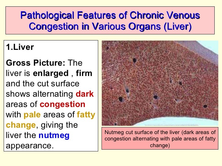 Circulatory disturbances