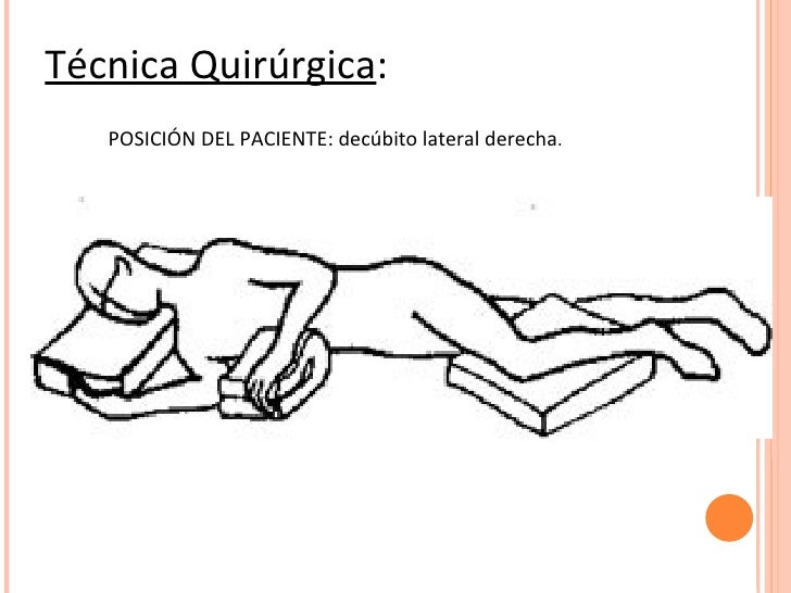 Cirugia toracica Cirugia toracica