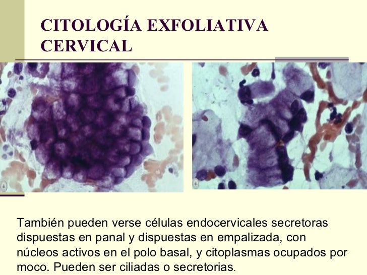 Citologia Exfoliativa Oncologica Como Se Hace www.slideshare.net