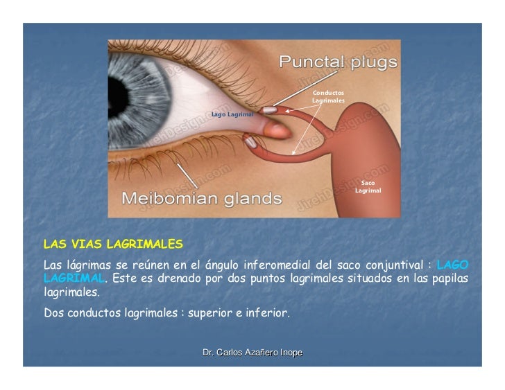 Las ojeras oscuras que aceite