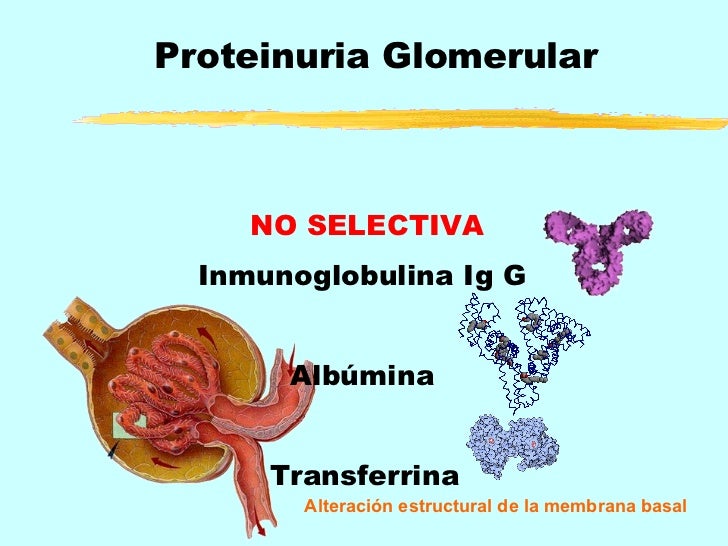 Proteinuria y sus causas
