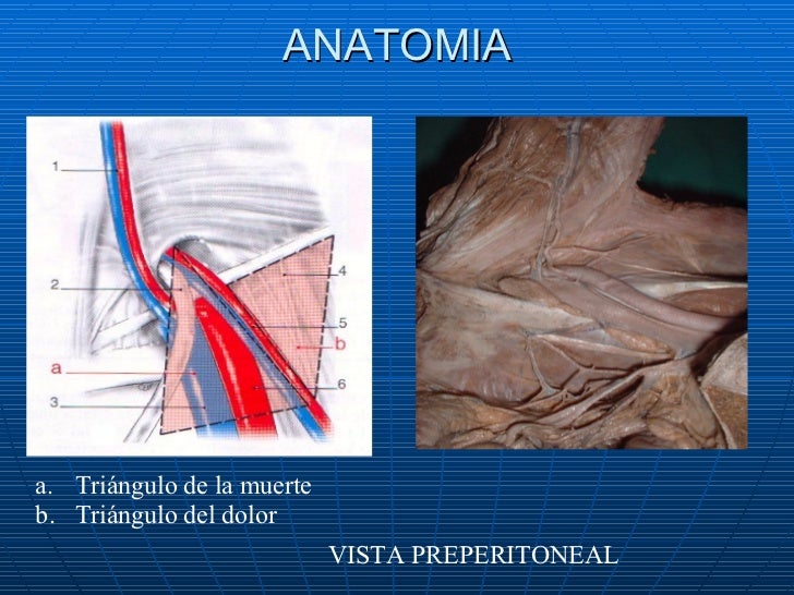 Clase Hernia Inguinal 06