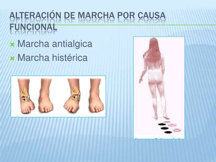 Clase 09 ex fisico neurologico 2011