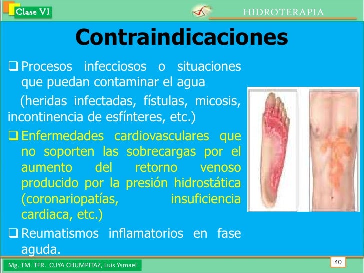 Las revocaciones sobre el médico el aumento del pecho