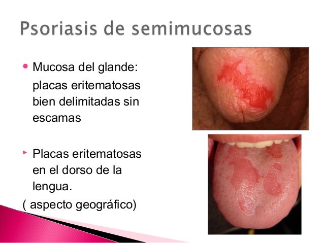 El aceite para el baño a atopicheskom la dermatitis