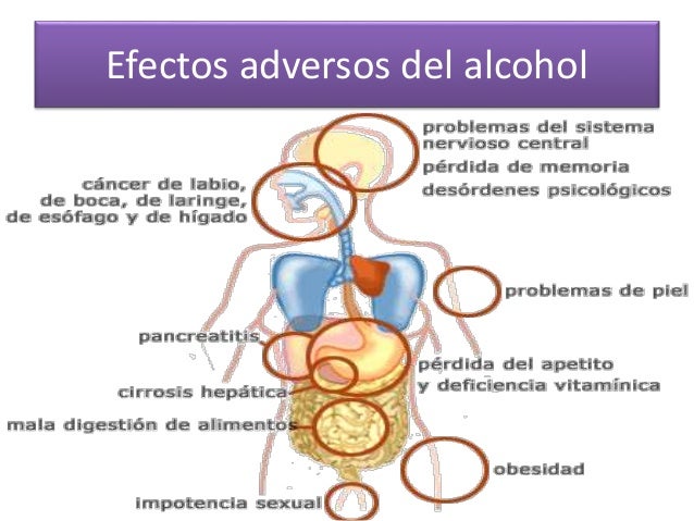 Que sustituir kolme las revocaciones
