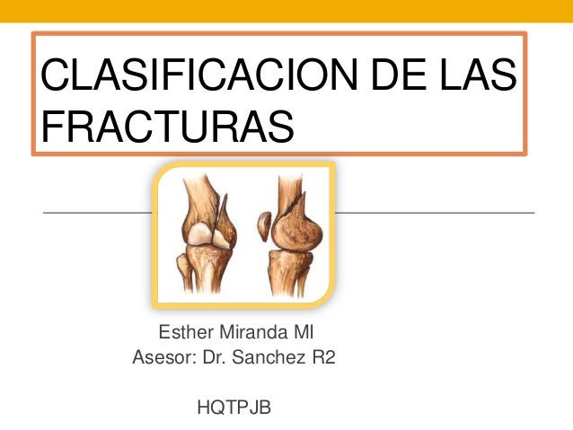 TIPO CLASIFICACION tipo clasificacion: