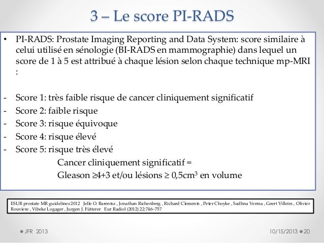 Classification pi rads Classification pi rads