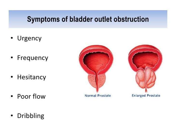 Clinical manifestations of_renal_diseasesffff copy (2)