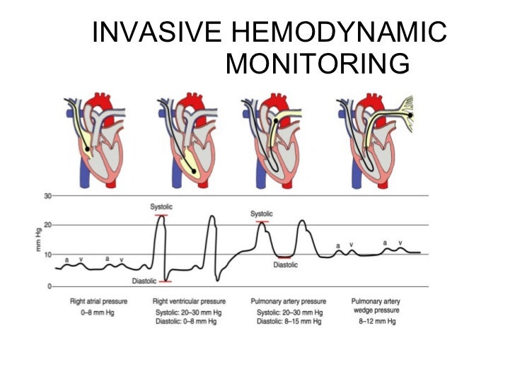 Clinical monitoring in ICU