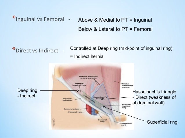 Superficial Inguinal Ring Surface Marking Superficial Inguinal Ring Surface Marking
