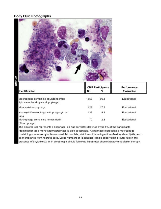CAP's Survey in Clinical Microscopy 2013