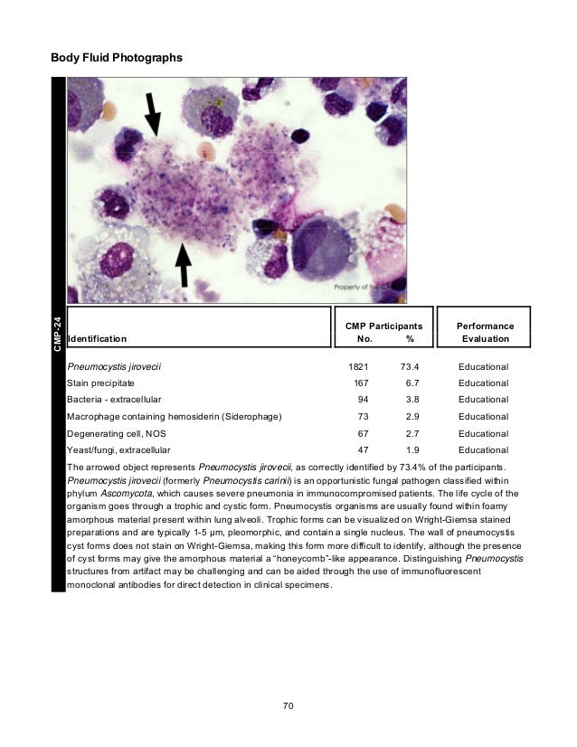 CAP's Survey in Clinical Microscopy 2013