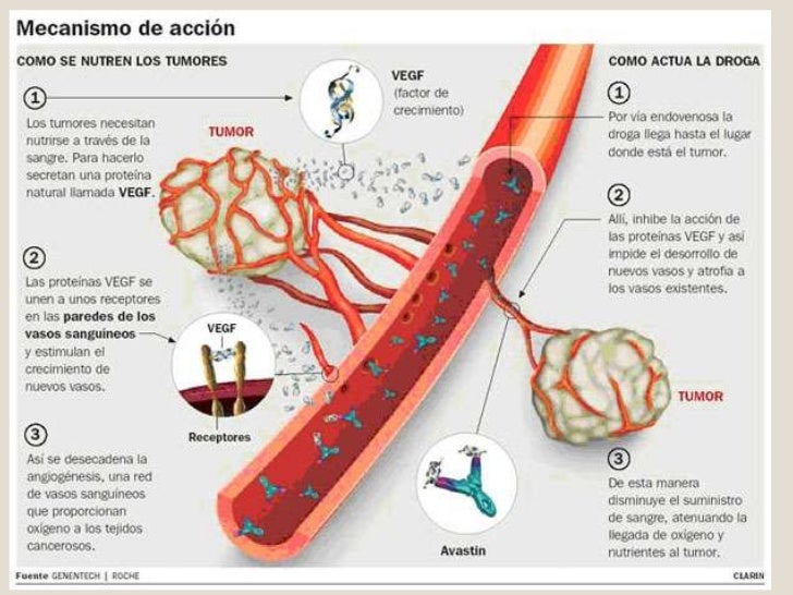 De que a la persona la psoriasis