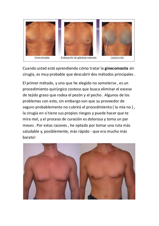 Las hormonas del aumento del busto