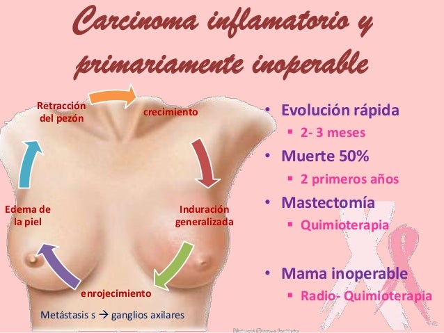 Como hacer la máscara para el aumento del pecho