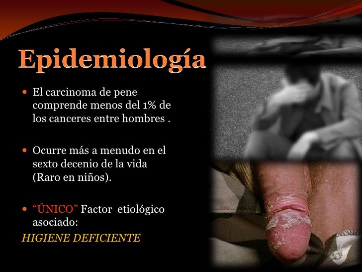 Videos De Negros De Grande Penes | vergas grandes de hombres negros ver video streaming Videos De Negros De Grande Penes | vergas grandes de hombres negros ver video streaming