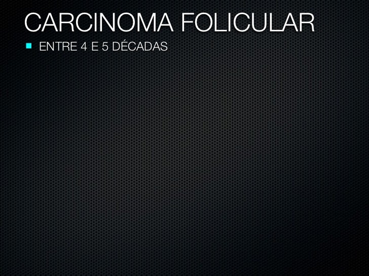 Metastase De Carcinoma Papilifero Da Tireoide