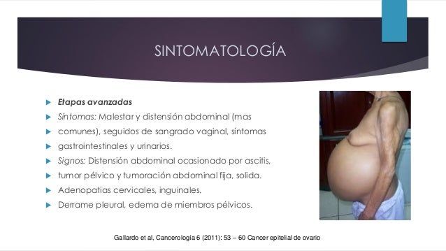 cancer incidental de vesicula biliar en pacientes submetidos a colecistectomia cancer incidental de vesicula biliar en pacientes submetidos a colecistectomia