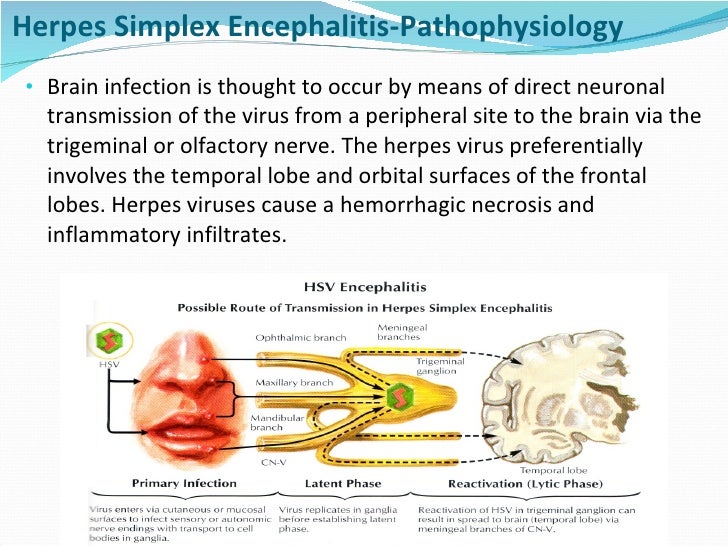 Cns Infections Immunocompromised Diet