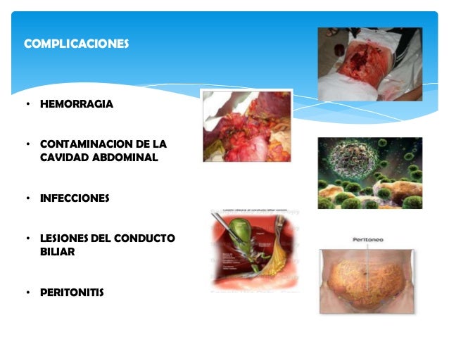 Tomar orlistat tengo no vesicula puedo biliar