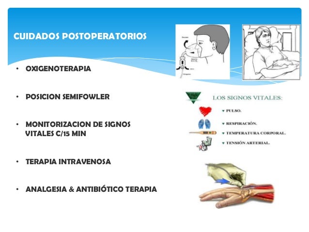 Colecistectomia