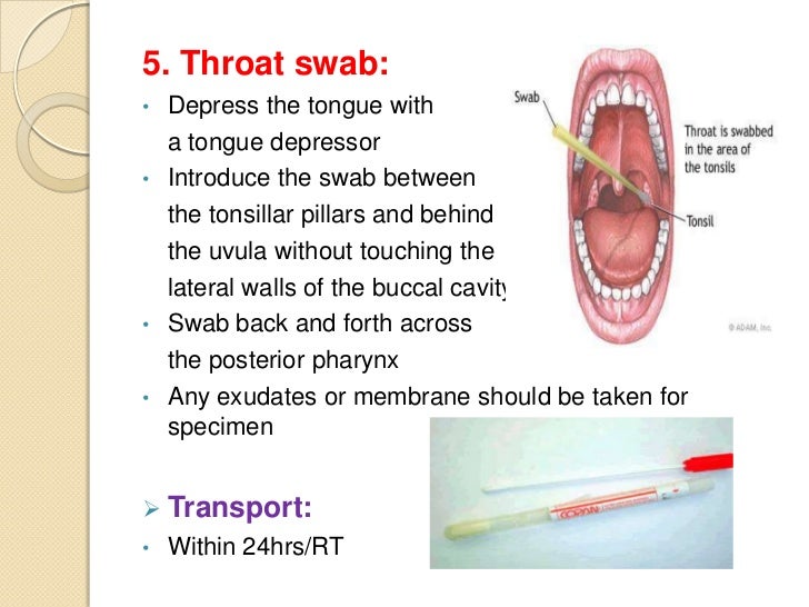 How To Do A Throat Swab 43