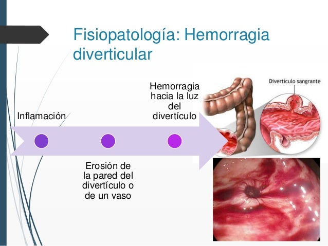 La tintura de las hierbas del litoral del alcoholismo