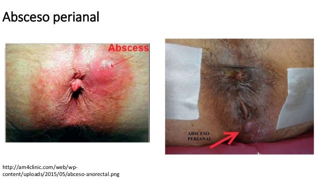 El pelo no anal a mexicana y recibiendo mecos en la cara 9