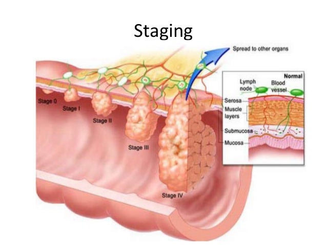 Related image