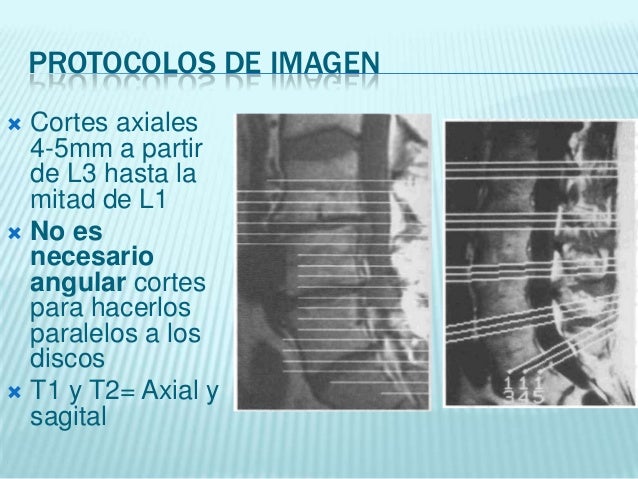 El dolor en la coyuntura cubital a la osteocondrosis el tratamiento