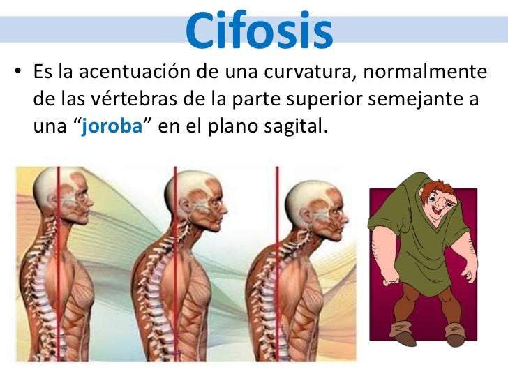 Que puede estar enfermo del lado izquierdo por parte de la espalda