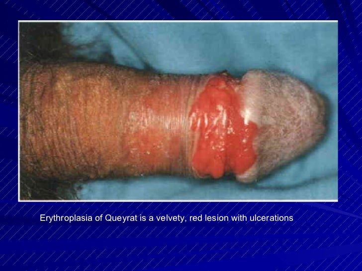 Red to dark dots on the scrotum - Dermatology - MedHelp
