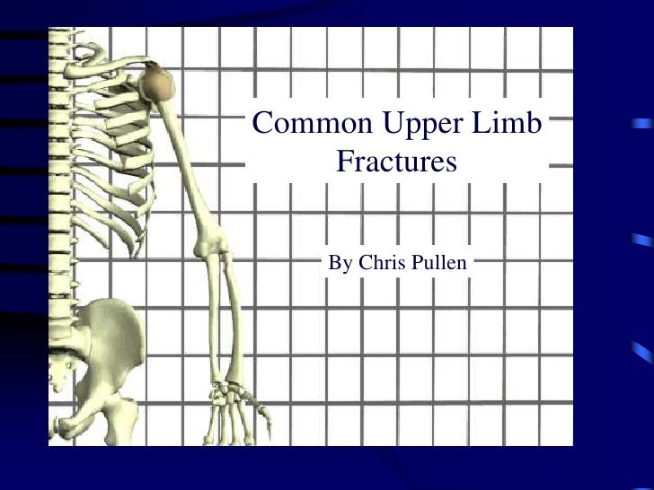Common Upper Limb Fractures