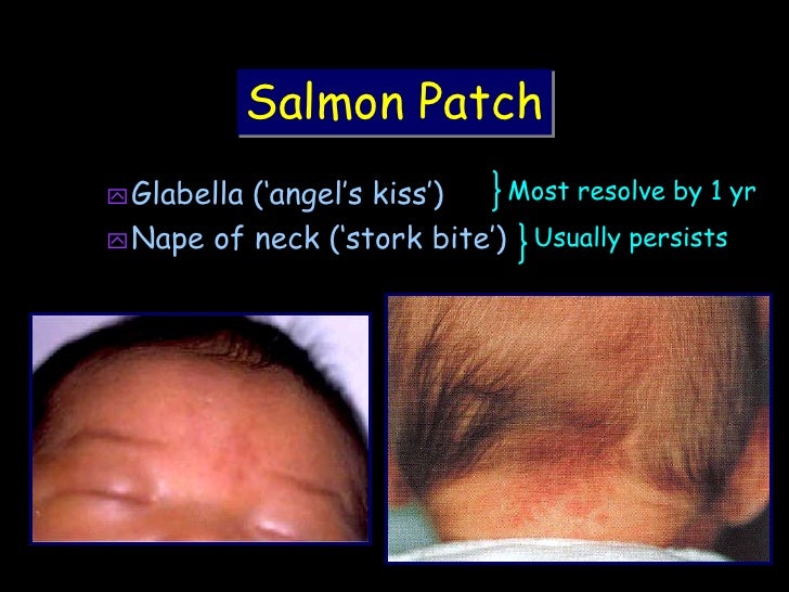 Common neonatal problems