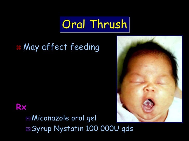 Common neonatal problems
