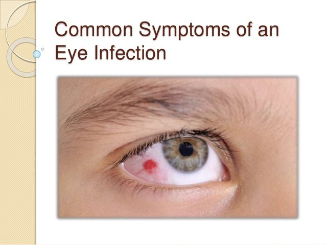 eye infection symptoms common symptoms of an eye infection eye infection symptoms common symptoms of an eye infection
