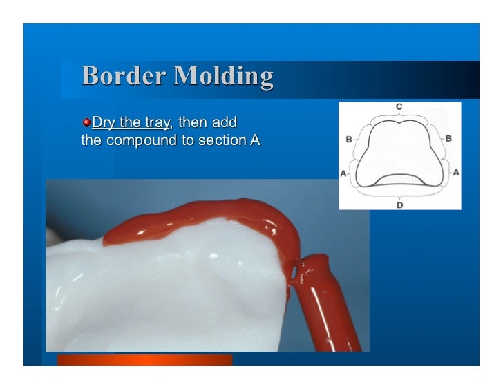Complete dentures 7. final impressions