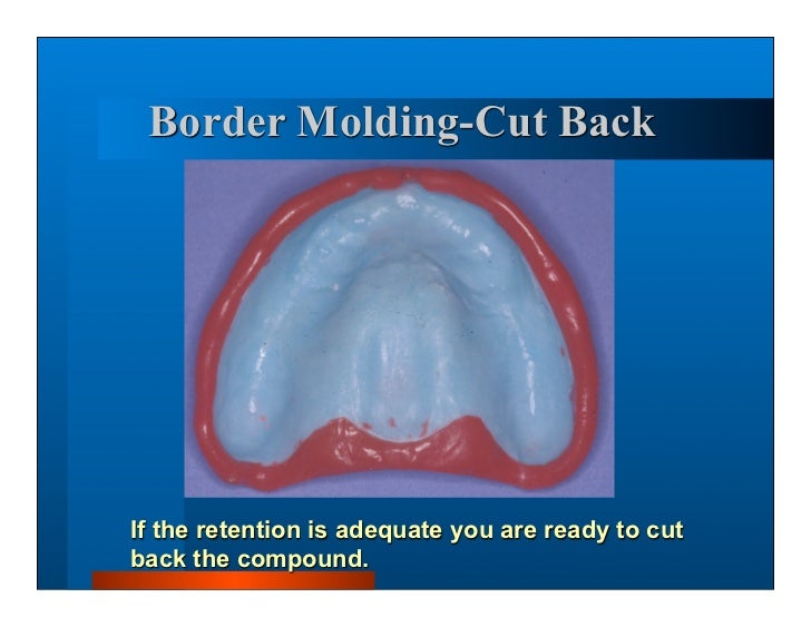 dentures denture