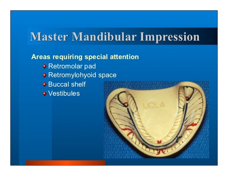 Complete dentures 7. final impressions