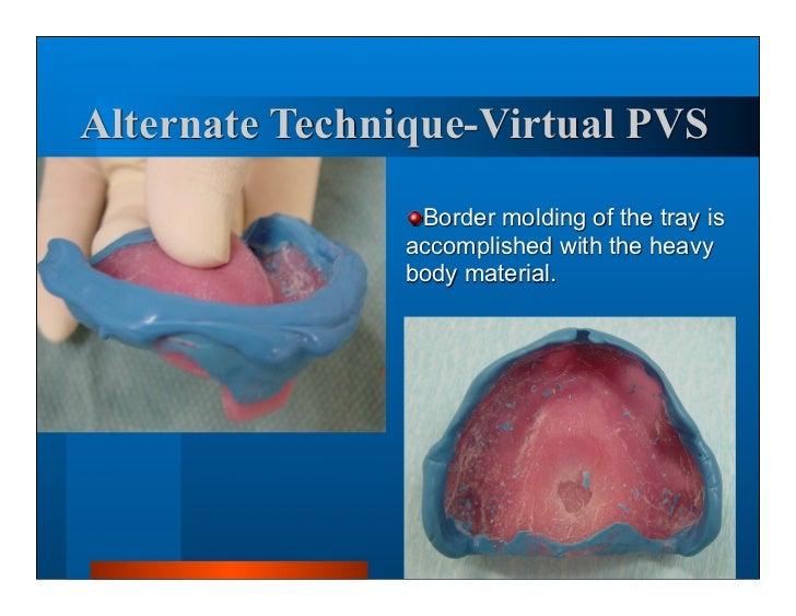 Complete dentures 7. final impressions