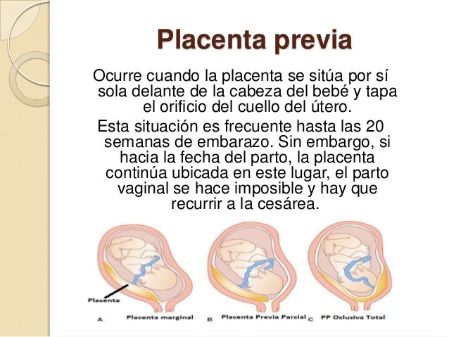 El complejo de los ejercicios en la sala a la osteocondrosis