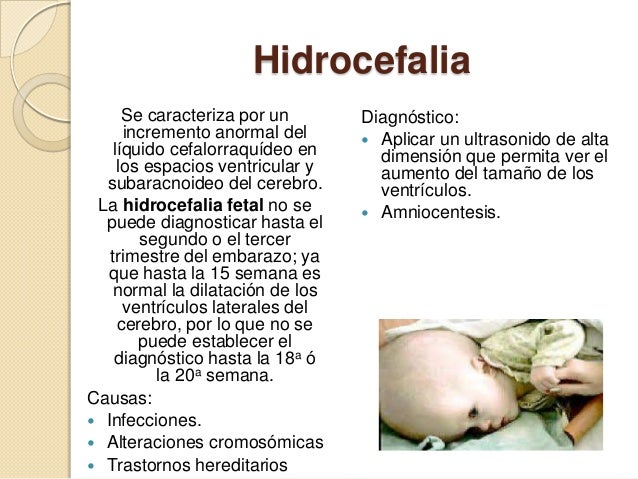 Complicaciones en el embarazo. Complicaciones en el embarazo.